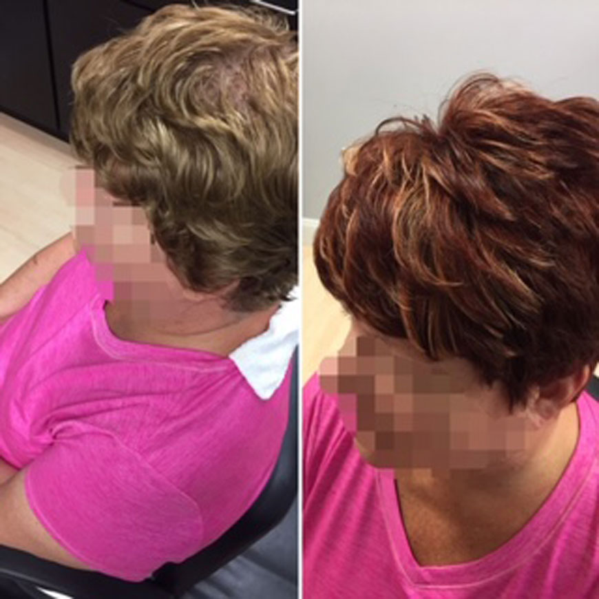 EMG Salons Before and After Photos